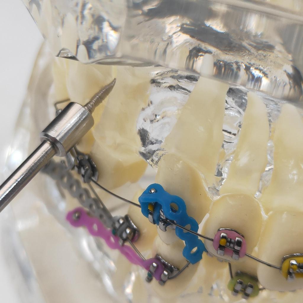 Мини-отвертка для зубного имплантата, ортодонтическая фиксация, шестигранный винт, ключ 20 мм, отвертки с коротким стержнем, инструмент, соответствующий контруглу