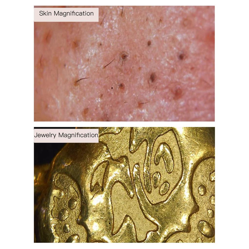 Wireless Digital Microscope, 800X Magnification USB Skin Diagnostic Hair Follicle Analyzer, WiFi Portable Handheld Microscope, Skin, Hair, and Scalp