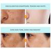 Dark Hyperpigmentation Remover For Face, Dark Hyperpigmentation Serum,Age,Brown,Acne ,Melasma Brown Dosing With Niacinamide For Women And Men 30G