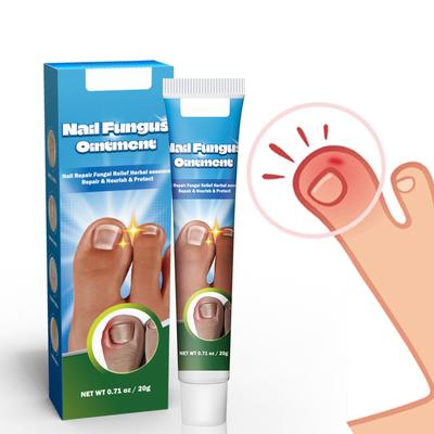 Крем для ухода за онихомикозом Мазь для здоровья ногтей Ноготь
