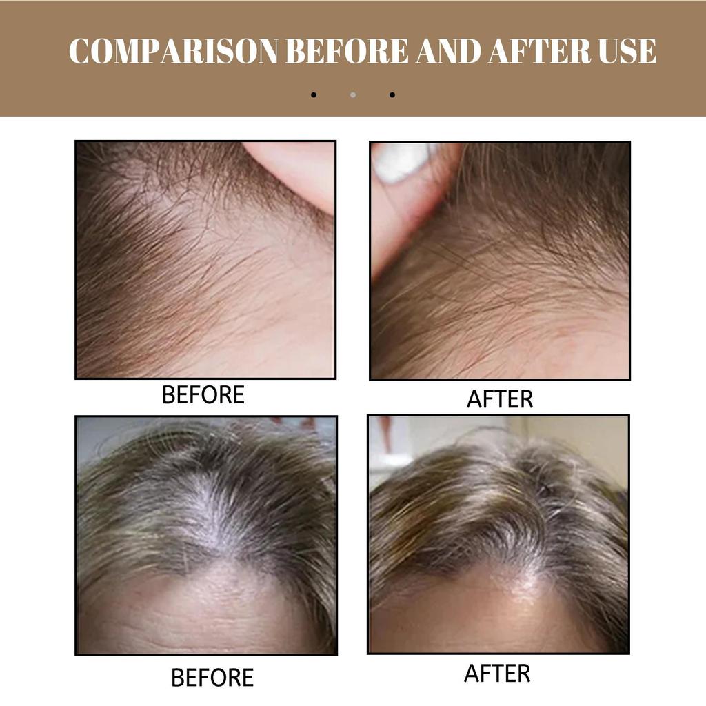 EELHOE Рисовое мыло-шампунь против выпадения волос 100 г контроль жирности /глубокое очищение/ объемные /гладкие/ укрепление корней волос/ питательное восстановление/ против перхоти