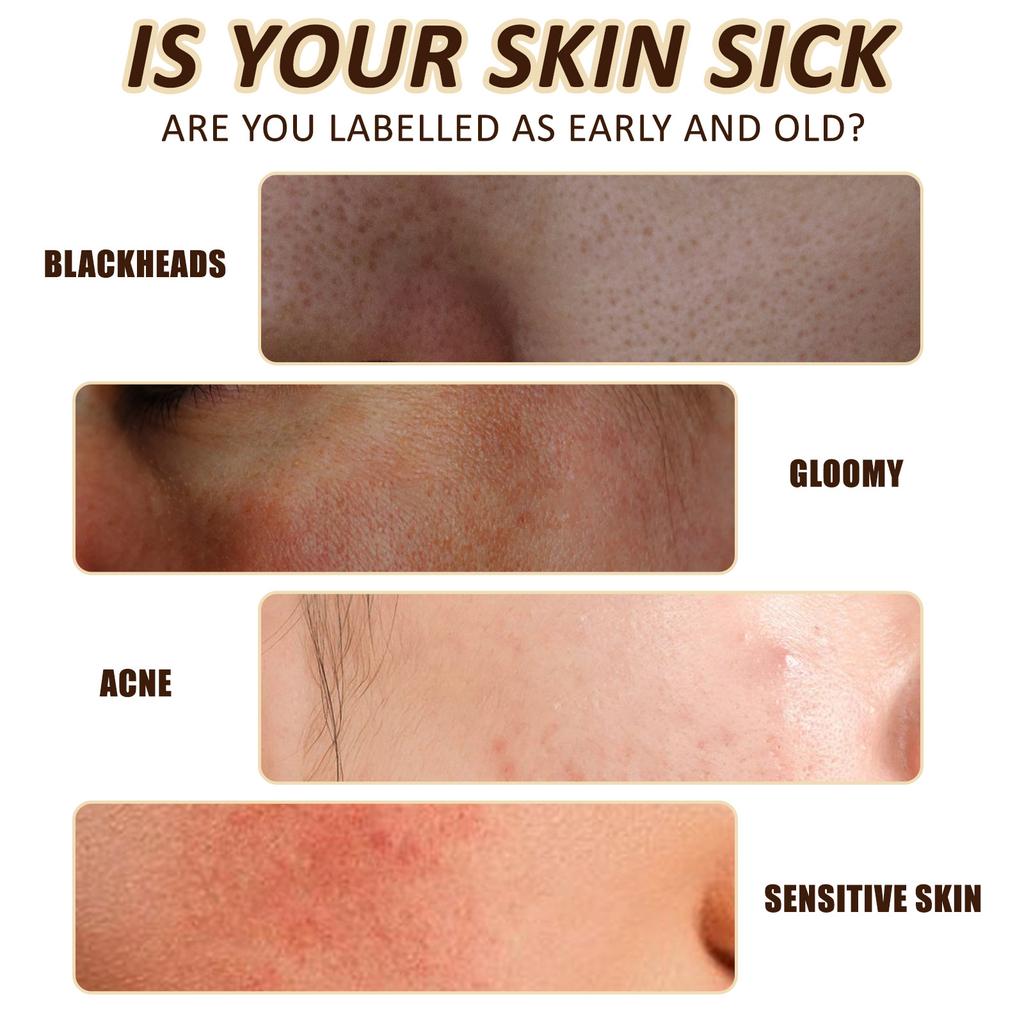 Медовая маска-пленка Сужает поры Уменьшает черные точки Увлажняет и питает Маска-аппликатор