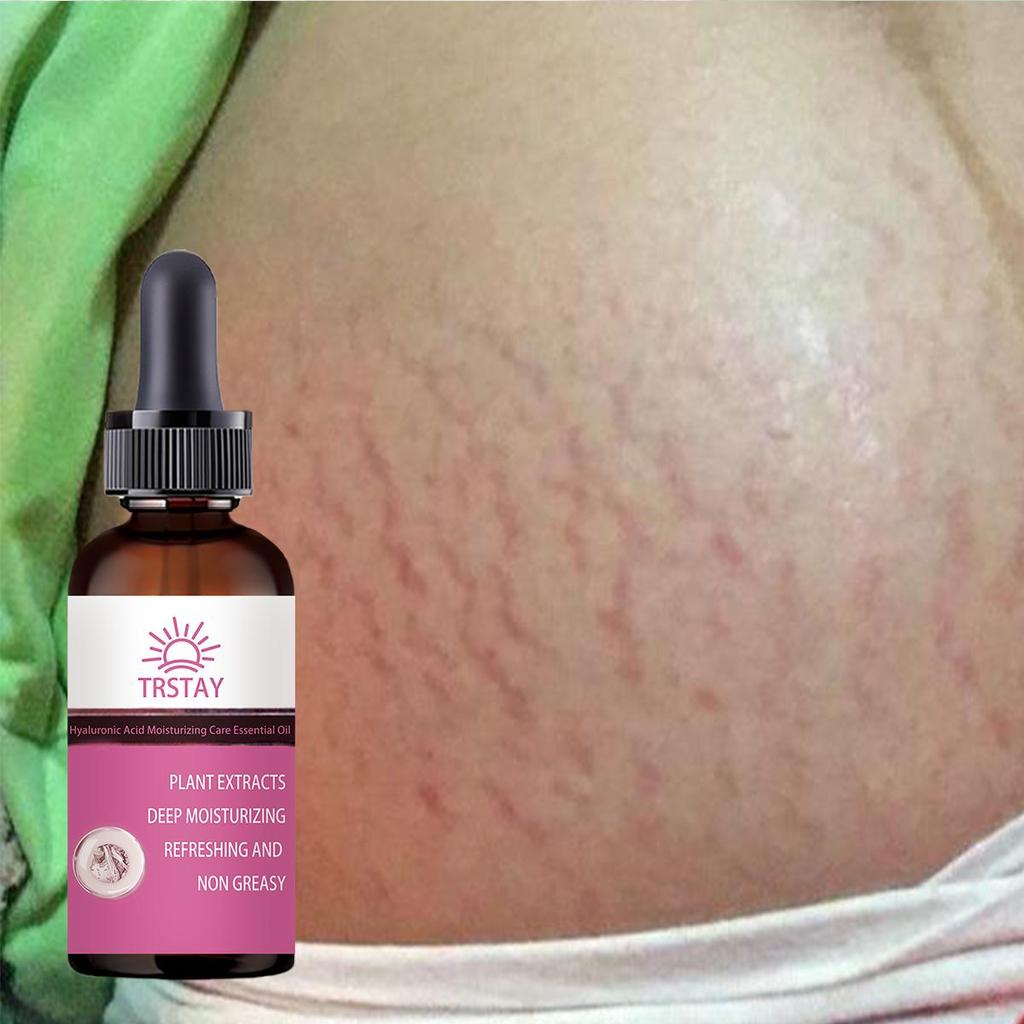 Pregnant Women Repair Belly Lines, Postpartum Repair Cream, Prevention Body Cream, Moisturize Skin , Remove Pregnancy Lines, Fat Lines, Face Cream