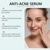 Limited time!!Ouhoe Pore Care Essence Gentle Cleansing Facial Skin Acne Tender Skin Facial Treatment Essence