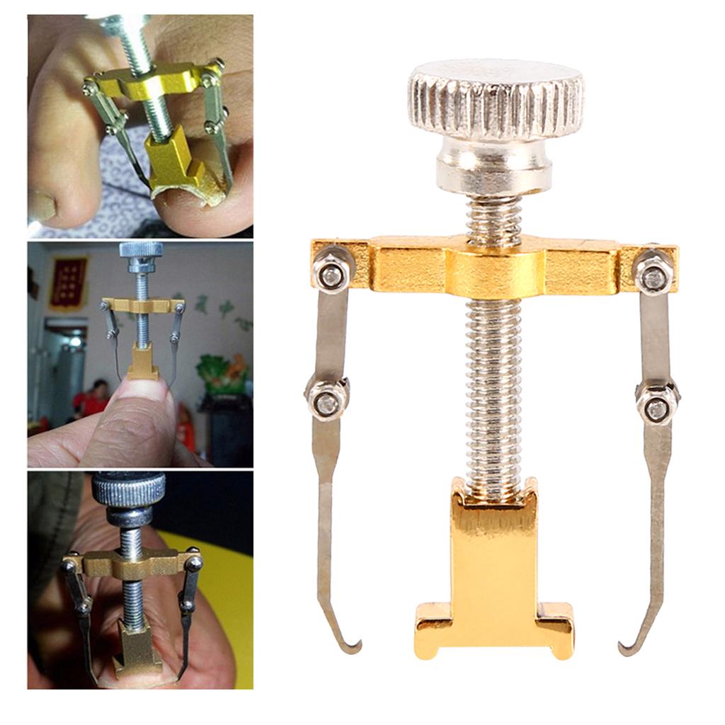 Профессиональный инструмент для восстановления и коррекции вросшего ногтя, фиксатор, маникюр, педикюр, уход за ногтями