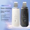 Ultrasonic Skin Scraper Exfoliator and Blackhead Remover