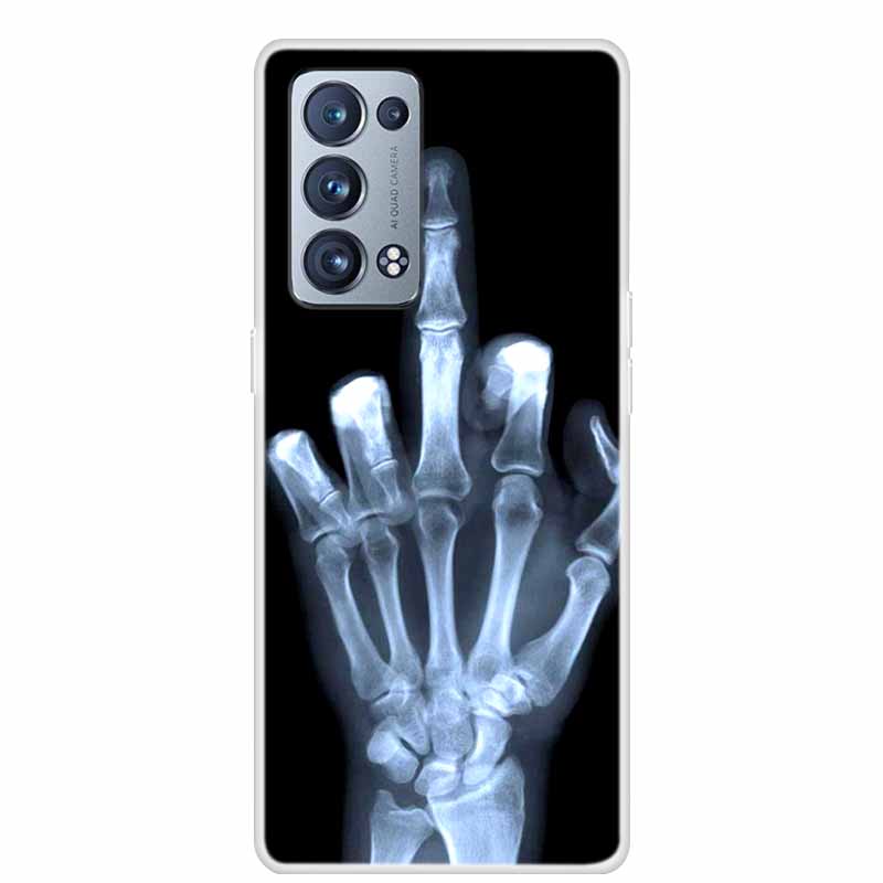 For OPPO Reno 6 Pro Plus 5G Case Reno6 Clear Marble Soft TPU Silicone Back Cover For OPPO Reno6 5G Phone Case Funda Bumper 6pro+