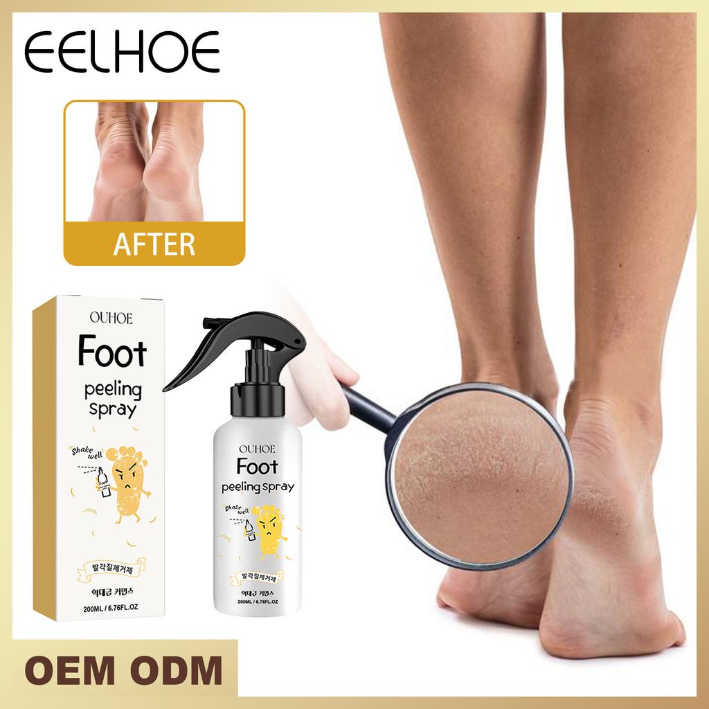 EELHOE Foot Peeling Spray Natural Orange Essence Pedicure Hands Dead Skin Exfoliator Mask Whiten Baby Foot Care Tool