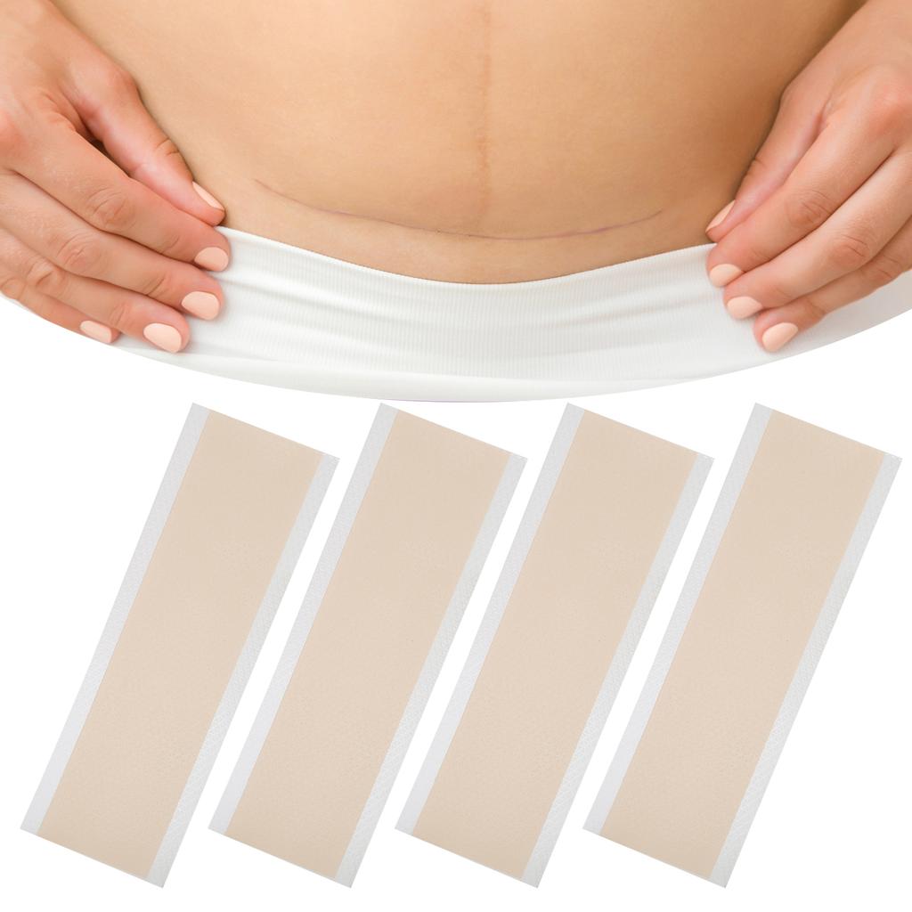 4pcs Silicone Scar Sheets Home Travel Reusable Adhesive Scar Removal Treatment Strips