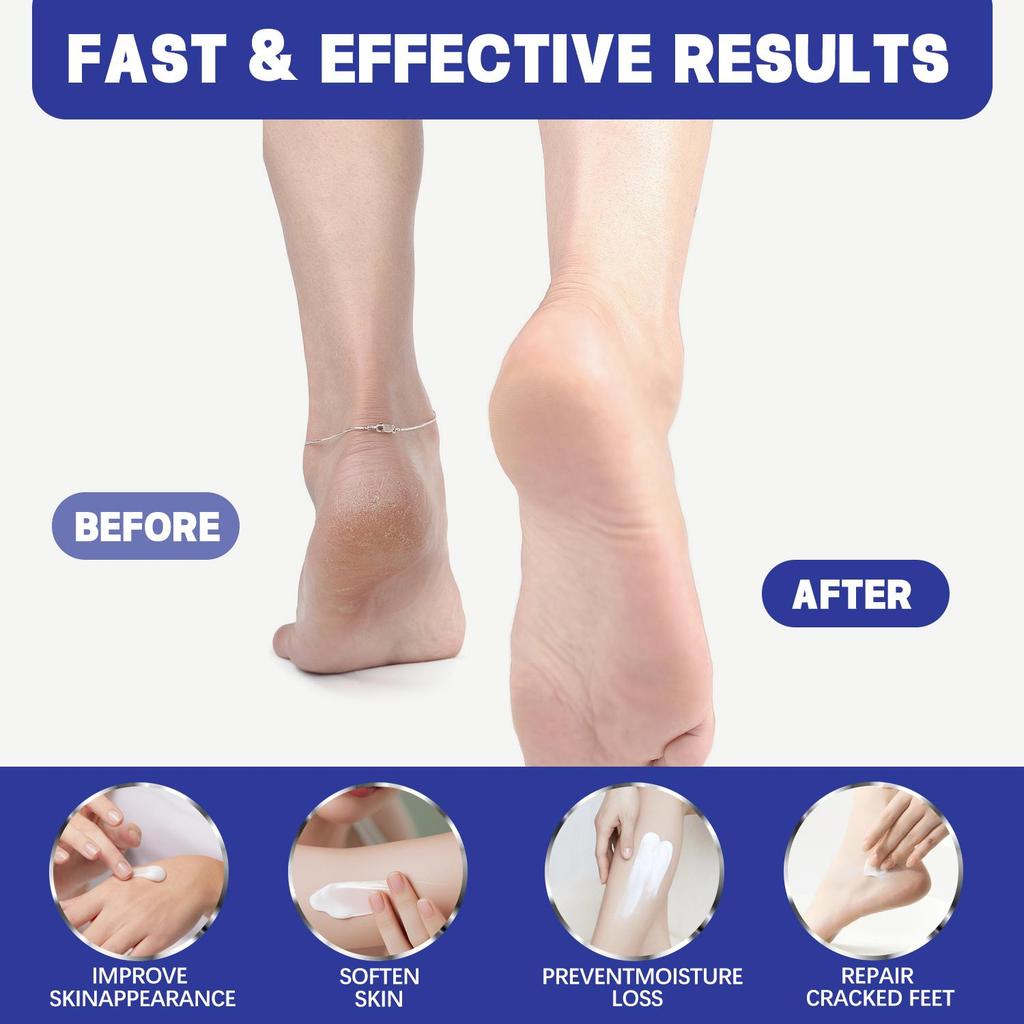 60% Urea Cream, Urea Foot & Hand& Body Cream, Exfoliating Cream, Moisturizer for Thick Skin, Cracked Skin Repair-200g