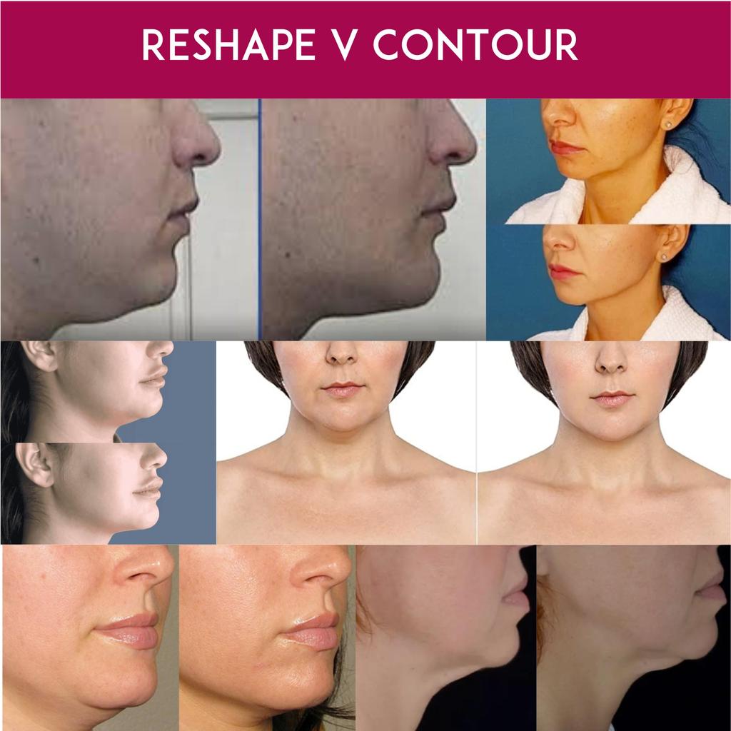 ANACIS Bella Contour Пенка для умывания 30 мл