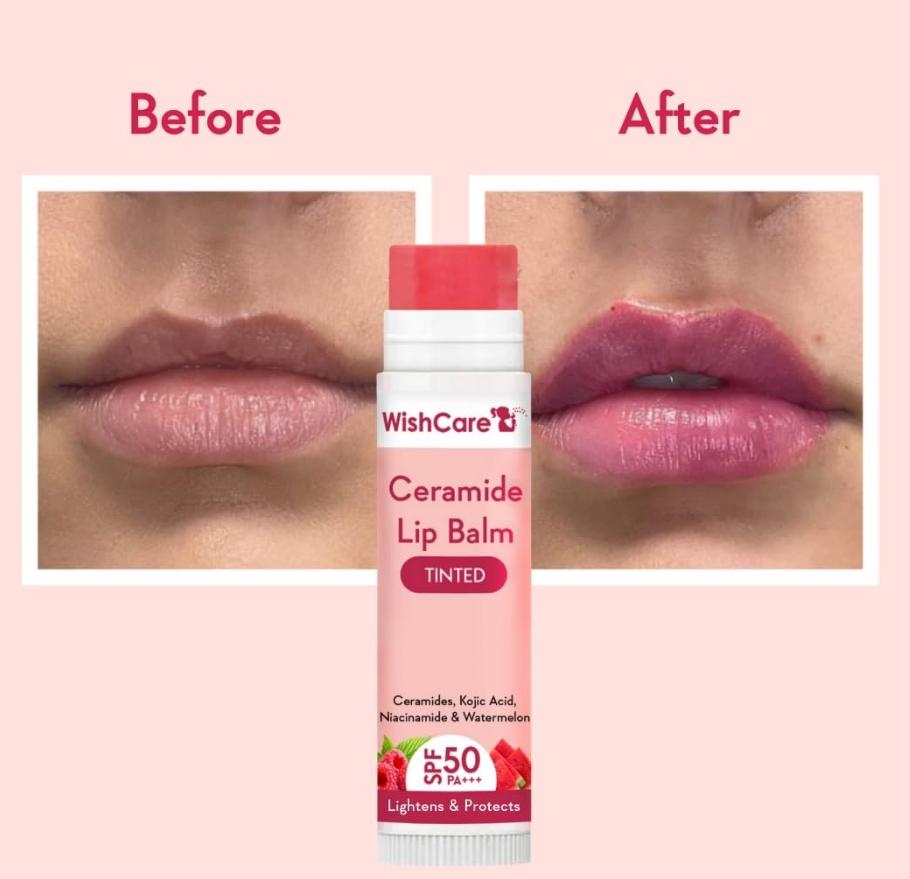 WishCare Тонированный бальзам для губ с SPF 50 PA +++ - Осветляющий бальзам для губ для темных губ с койевой кислотой и ниацинамидом - SPF бальзам для губ для женщин 5 г