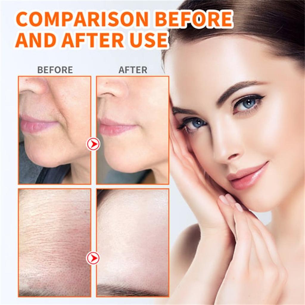 Dermarssance Type III Collagen Soluble Facial Dissolves In, Raises Lines And Wrinkles Filling Tablet, High-quality Collagen Film