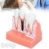 Модель зубов Анализ зубного имплантата Модель короночного моста Демонстрационная модель зуба