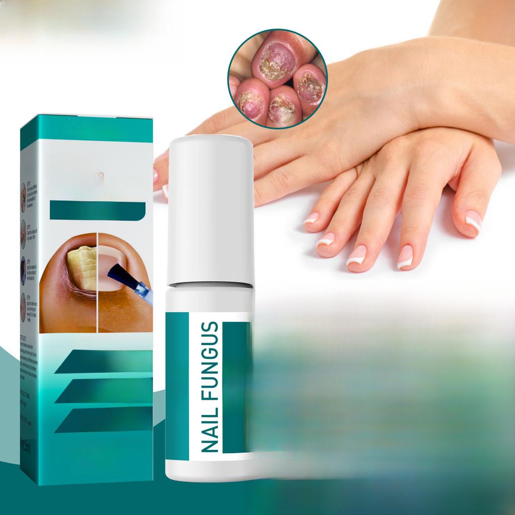 Премиальное средство для восстановления ногтей на ногах 5 мл Для обесцвеченных ногтей и смягчения ногтей