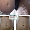 Pregnancy Cream Maternity Skin Repair Body Cream Stretch Marks Removal Cream Scar Care Postpartum Serum Smooth Skin Creams