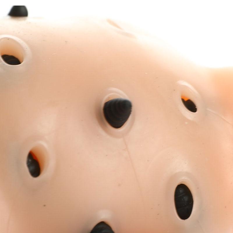 Blackhead Shape Pimple Toys Squeeze Acne Stress Relief Toys Remover Stop Toys