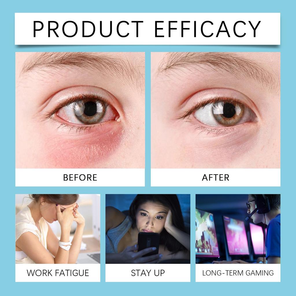 Eye Moisturizing Care Solution To Eye Dry Fatigue Moisturizing Eye Cleaning Eye Soothing Eye Drops To The Health Of13ml