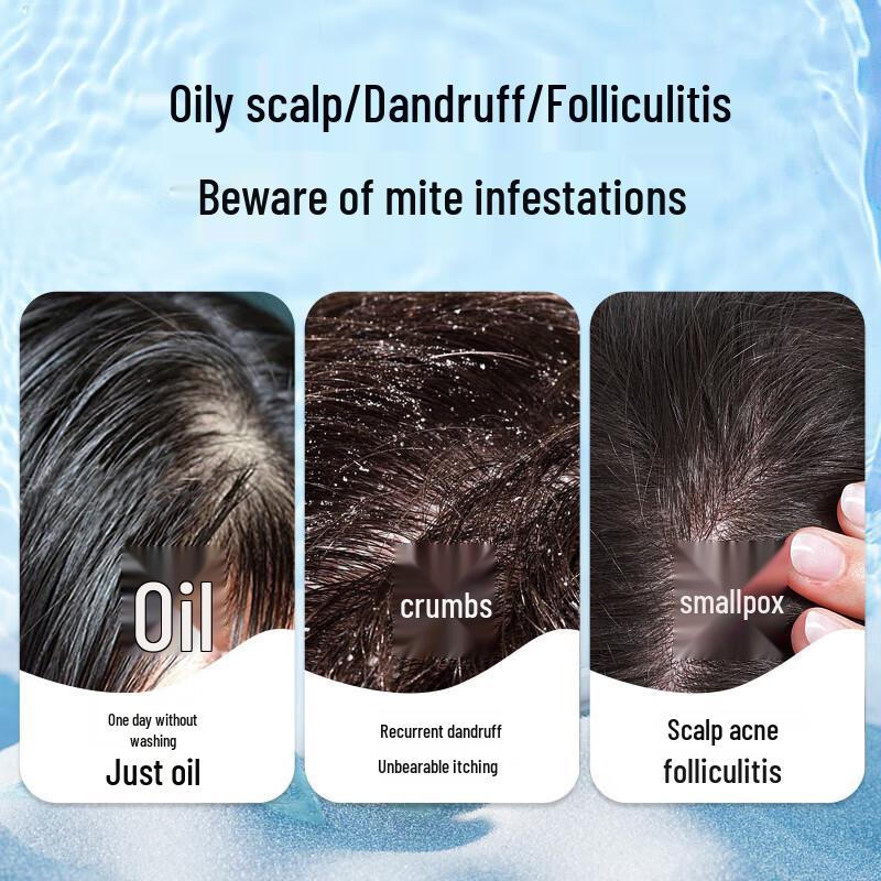 Green Valley Sea Salt Anti-Dandruff Oil Control Shampoo