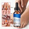 Repair Nail Fungus Treatments Essence Foot Care Serum Toe Nails Fungal Removal Gel Anti-Infection
