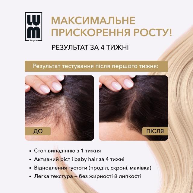 Набор LUM "90-дневный курс": активация фолликулов и формирование плотности"