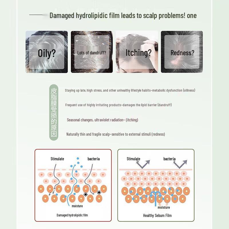 ShuLei Shimmering Oil Control Anti-Dandruff Shampoo