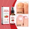 Rosehip Oil Nail Care Liquid Nourishing Moisturizing To Remove Onychomycosis Hand And Foot Nail Care Products Fungus Care 30ML