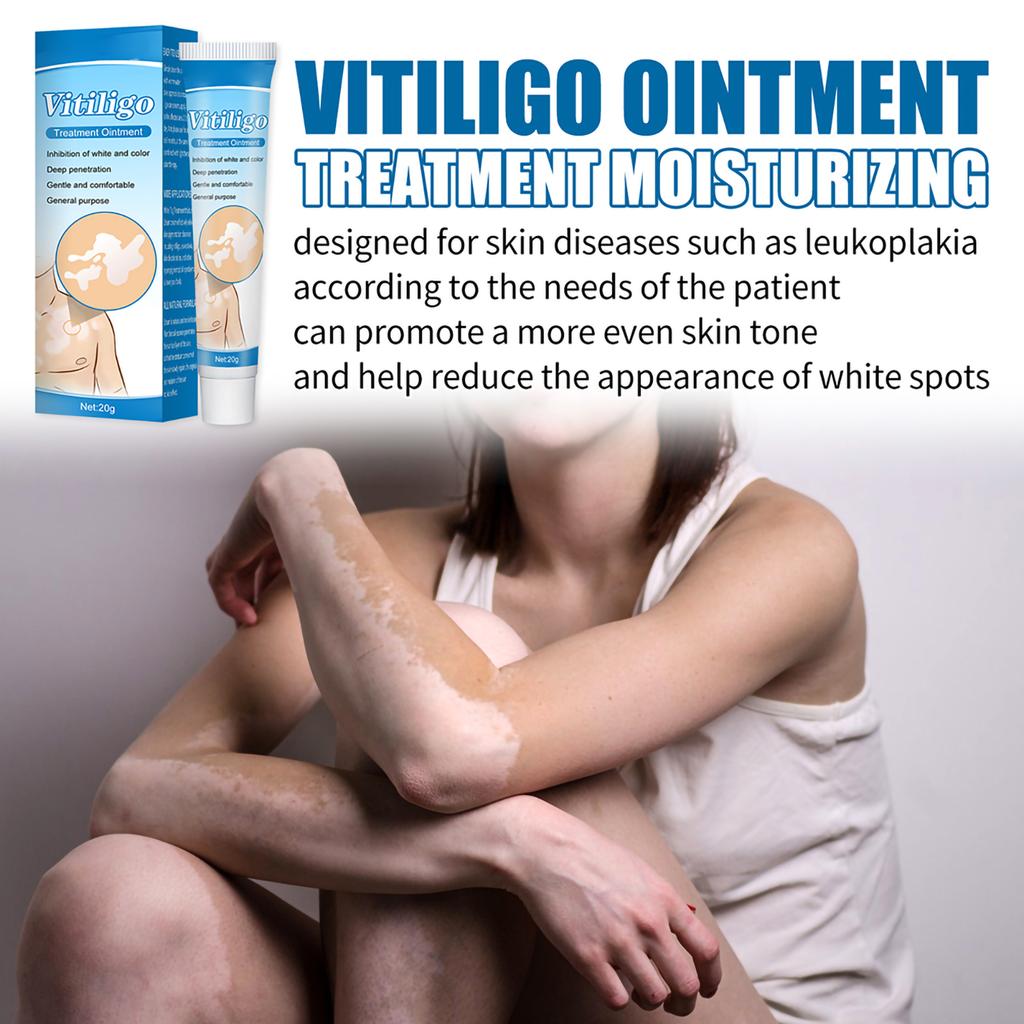 White Spot Piebald Cream Vitiligo Ointment Herbal Sweat Spot Cream Body Skin Care