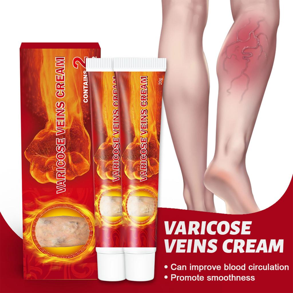 2pcs Health Cream For Relieving Varicose Veins, External Ointment For Vasculitis, Blood Circulation, Varicose Veins