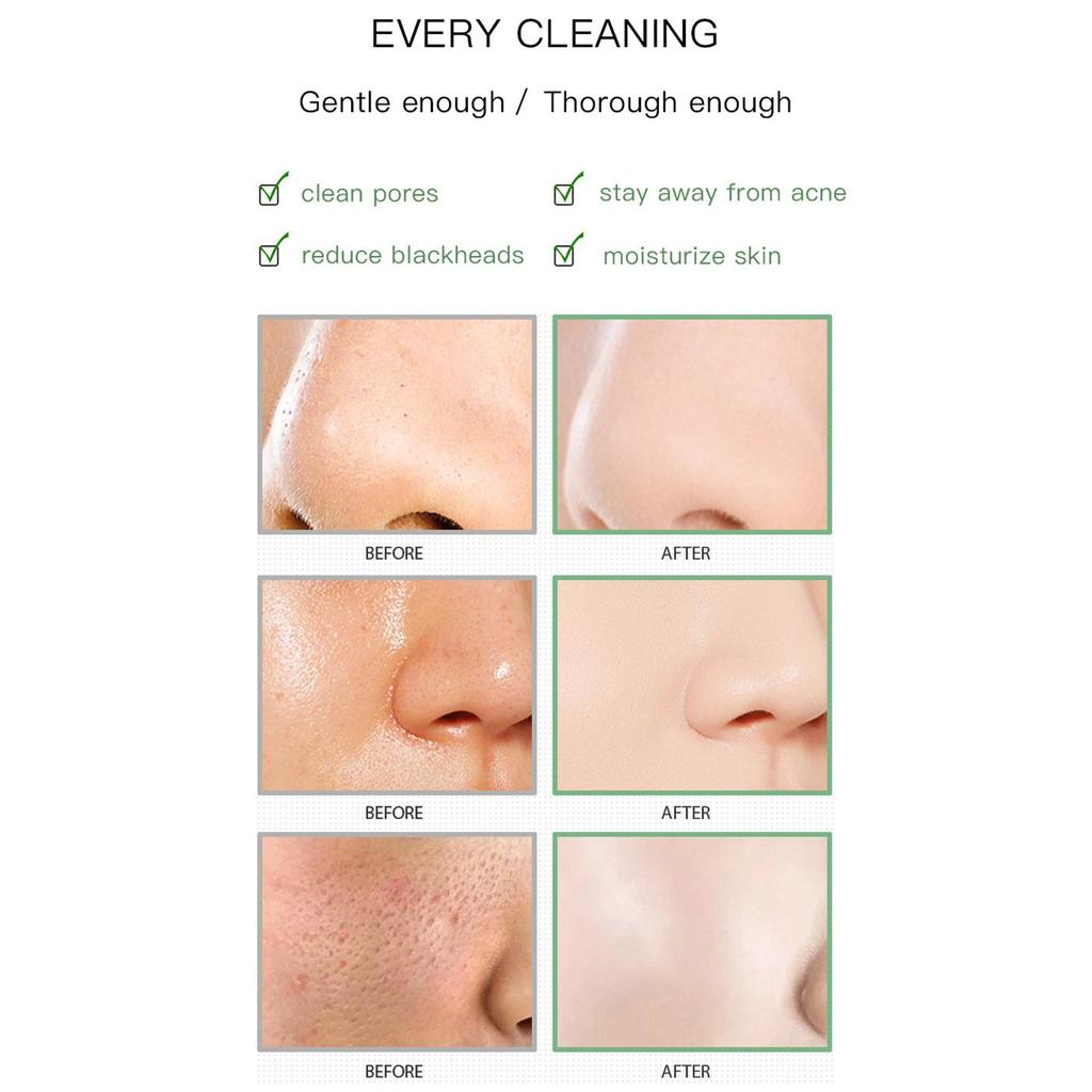 Грязевая маска с экстрактом зеленого чая 40 г для лица Средство для удаления угрей Контроль жирности Нежное очищение лица Твердая маска Натуральная