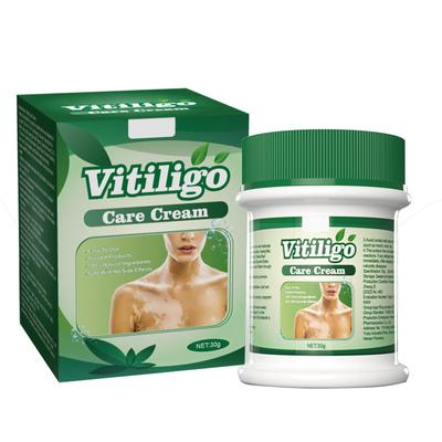 Крем для лечения белых пятен снимает симптомы кожи, устраняет потовые пятна и цветочные пятна, ускоряет рост волос