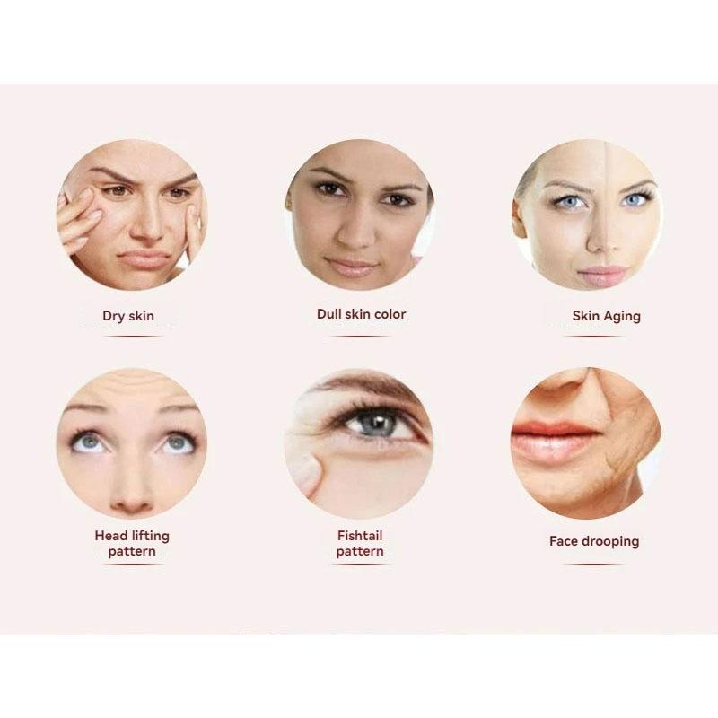 Ультразвуковое косметическое оборудование V-Face EMS RF, косметический массажер, лифтинг лица, электрический импульсный нож для красоты, омоложение кожи, отбеливание