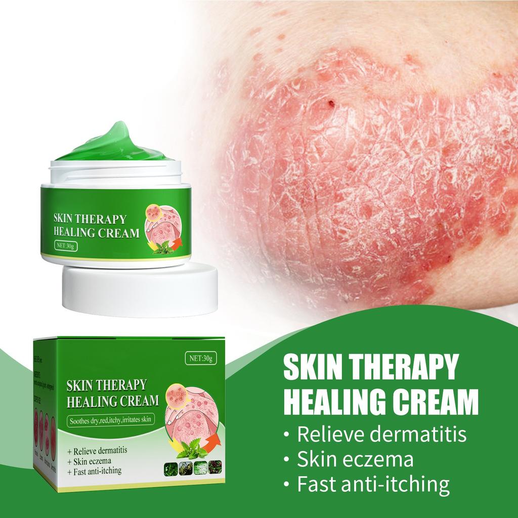 Moisturizing Skin Anainst Itch Cream,Remove Itching, Sweat Blisters, Skin Swelling,