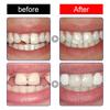 Jaysuing Plastic Denture Adhesive 30ml Plastic Resin Formula Quick-Setting, Brightening Dentures Smile Confidently and Shine