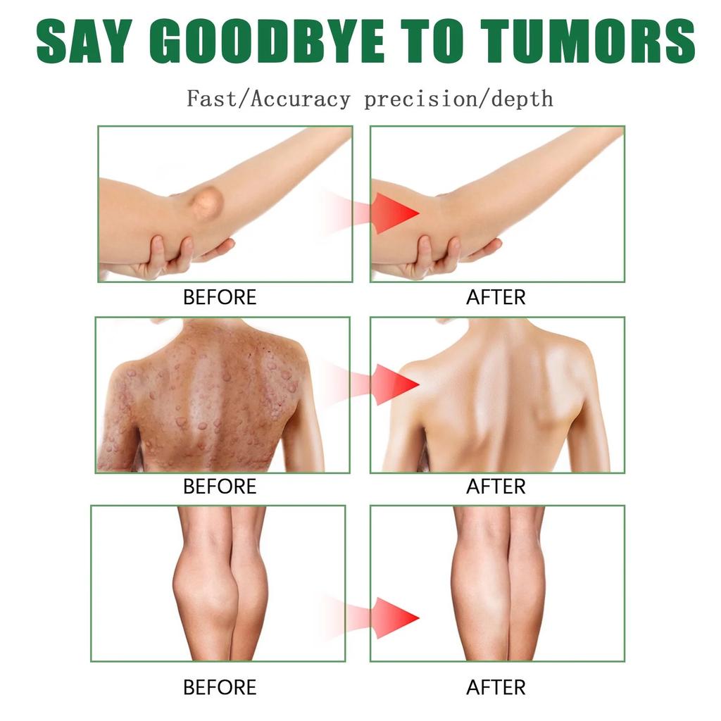 6PCS/Set Body Fix Patch, Body Discomfort Relief, Armpit And Neck Knot Fix Patch