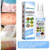 30ml Eczema Essence Non-Pungent Anti-Itch Herbal Extract Skin Salve Eczema Treatment Non Greasy Spray for Adult