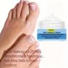 Super Nail Care Cream - No Fragrance, Gentle Formula, Suitable for Normal and Sensitive Skin, Multi Functional, Used for Toe and Nail Problems