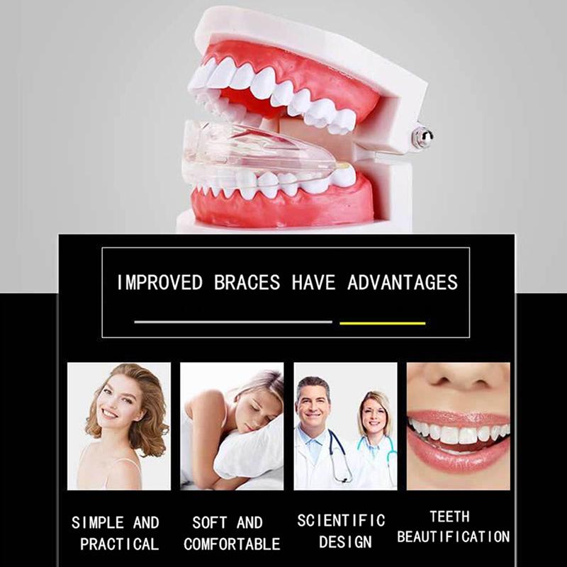 Dental Straightener Adult Fixed Silicone Braces Anti-Grinding Braces