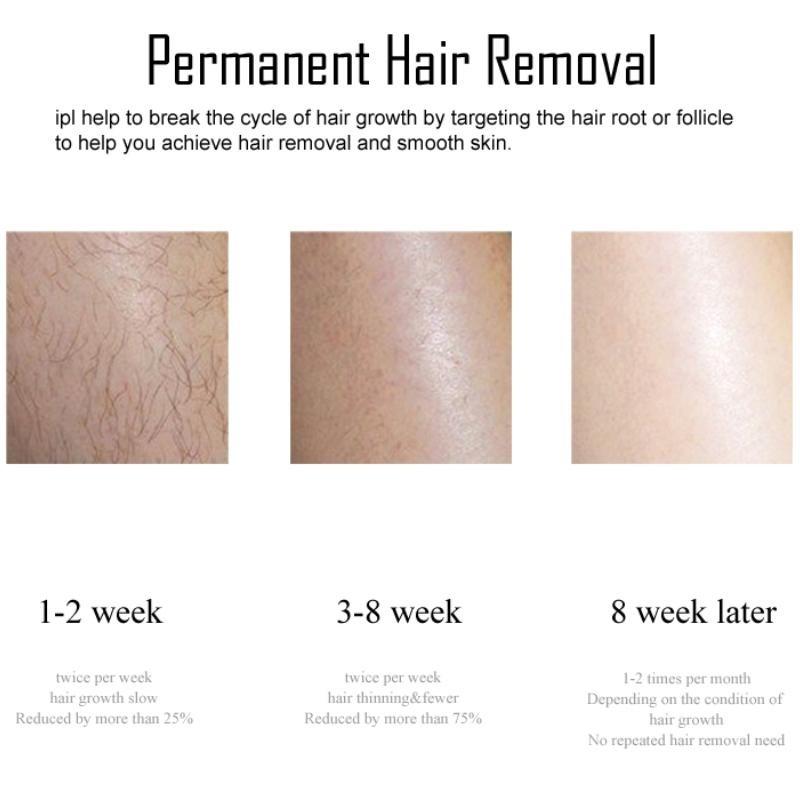 Многофункциональное устройство для лазерной эпиляции IPL 3 в 1, средство для удаления следов от прыщей, ледяное охлаждение, безболезненный эпилятор, омоложение кожи, унисекс, инструмент для удаления волос