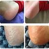 88g Anti Crack Moisturizing Hand Foot Cream Repairing Fissures Heal Ointment