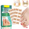 Ingrown Toenail Correction Stickers Hands And Feet Soft Nail Inlaid Nail Thickening Bright Nail Furrow Gray Nail Care Patch 50pcs
