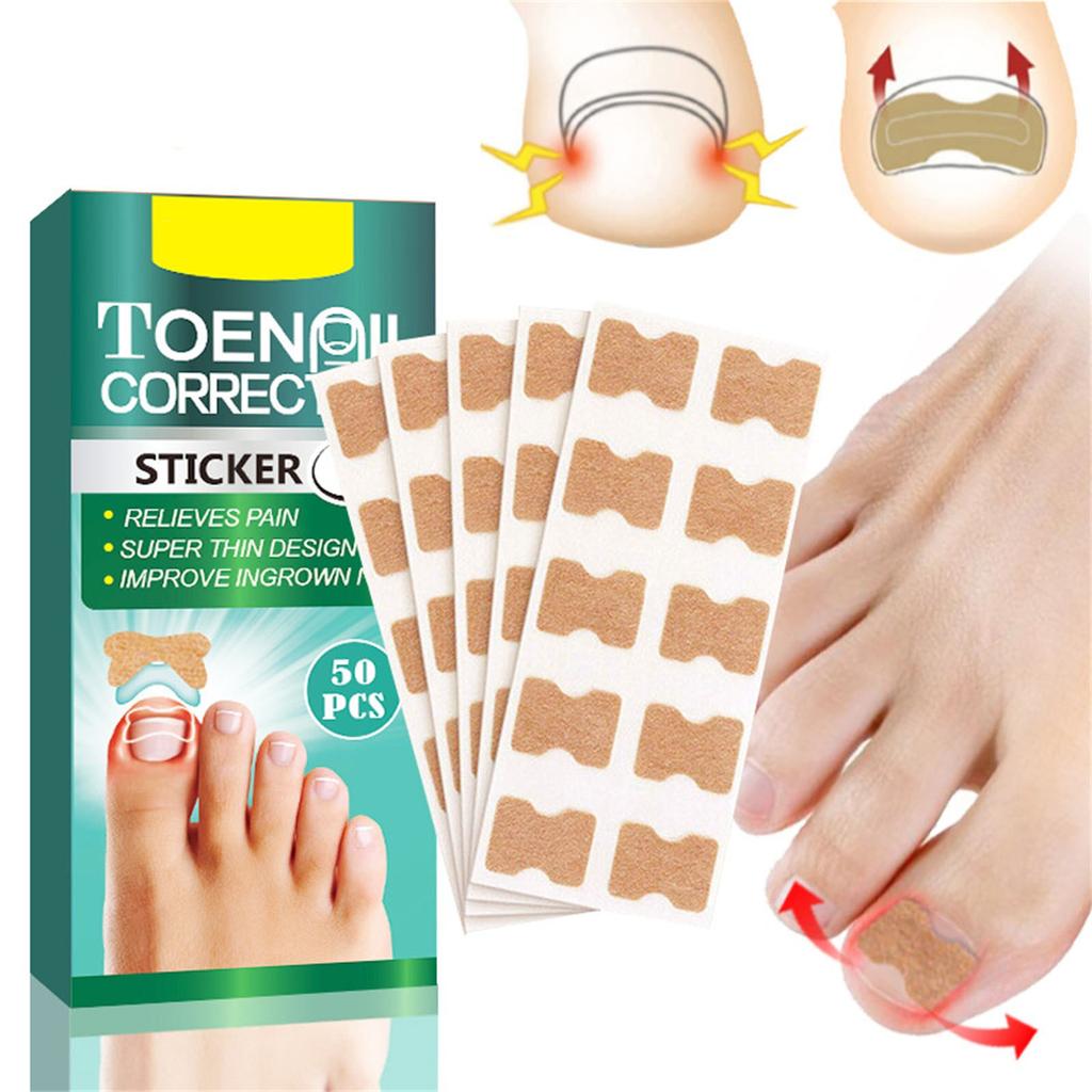 Ingrown Toenail Correction Stickers Hands And Feet Soft Nail Inlaid Nail Thickening Bright Nail Furrow Gray Nail Care Patch 50pcs