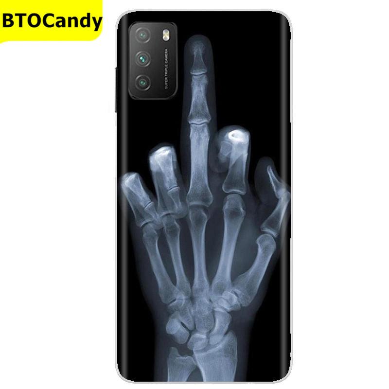 Чехол для POCO M3, мягкий силиконовый чехол для задней панели телефона для Xiaomi Poco M3 Pro 5G, задняя крышка, мягкий чехол из ТПУ для POCO M 3 M3, силиконовый чехол