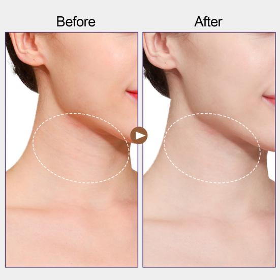 Instant Neck Lift Tape Straps Waterproof Neck Patch for Face