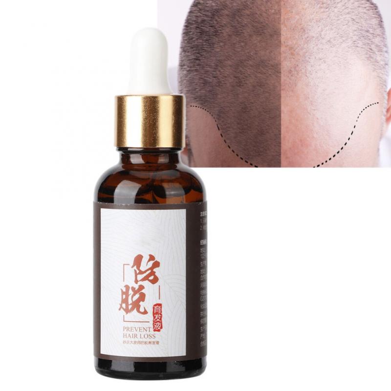 Daily scalp care, a fast-acting formula to promote hair growth, balances oil secretion, use 2-3 times daily 2pcs