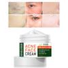 Эффективный крем для удаления прыщей, лечение прыщей, исчезновение пятен от прыщей, контроль жирности, сужение пор, отбеливание, увлажняющий крем от прыщей, уход за кожей