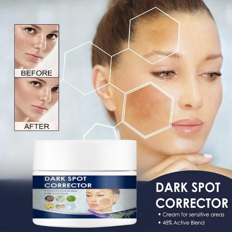 Отбеливающий крем от веснушек, крем для удаления мелазмы, удаление темных пятен, против морщин, осветление, увлажняющий уход за кожей для унисекс