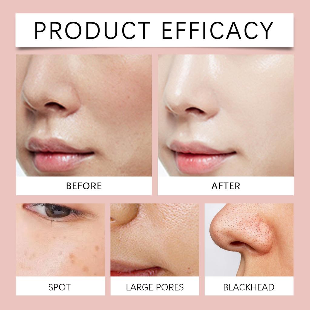 Очищающая грязевая маска с розой, нежное очищение кожи лица, нежная и увлажняющая маска-мазь