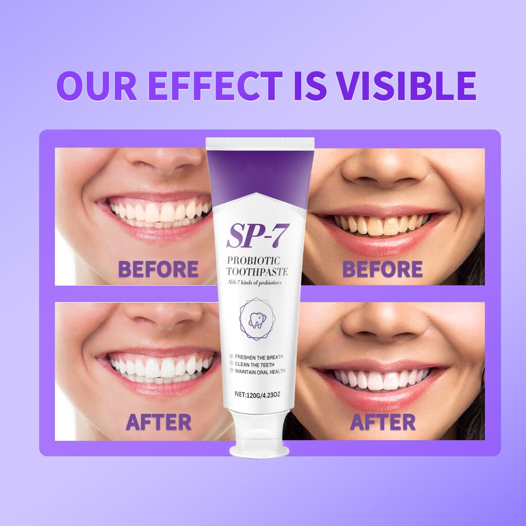 Sp-7 Probiotic Toothpaste Whitening,sp-7 Ultra Whitening Toothpaste, Promotes Healthy Teeth And Gums, Whitens Teeth