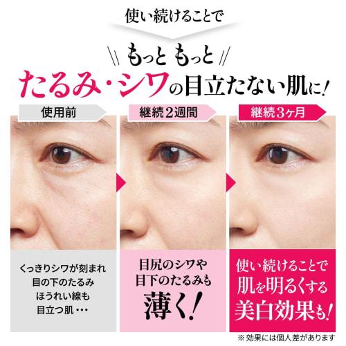 Лекарственный набор для улучшения морщин носогубные складки межбровные морщины провисание лба ниацинамид ретинол морщины ремонт na 30g